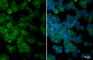 Anti-TAS1R3 antibody [HL4747] used in Immunocytochemistry/ Immunofluorescence (ICC/IF). GTX644751